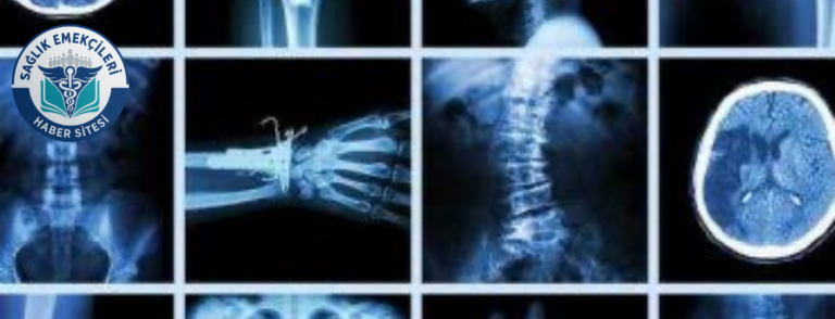 radyoloji-skandali-iddiasi-savcilik-harekete-gecti-yanlis-raporlar-mercek-altinda-saglik-emekcileri-haber-kanali-YUugXRdD.png