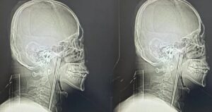 8-yil-boyunca-bogazindakiyle-yasadi-yDHSxrgA